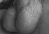 Pilosité du 8
