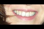 le-plus-beau-sourire-du-monde