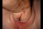 fist-vag1-002.jpg