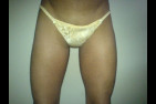 soumis-laulopette00001.jpg