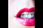 lips-ring.jpg