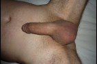 Erectl (1)