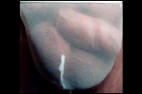 stringblanc