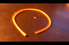 catheter