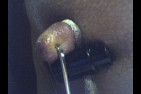balls096