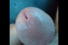 gland 1