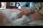 epilation (2)