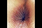 anus