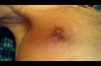 12 - Le Torse - B - -.-