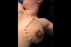 Aiguilles dans les seins2 (118)