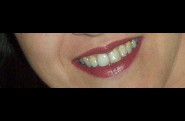 le-plus-beau-sourire-du-monde