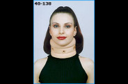 soft-collar.jpg