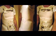 torse_cou_erectbrace.jpg