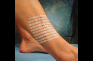3m-steristrip.jpg