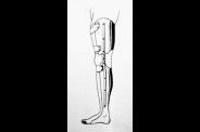 Orthèses de jambes/ Leg Braces