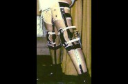 legbraceman.jpg