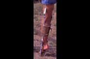 legbracewoman.jpg