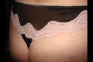 fesses