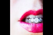 lips-ring.jpg