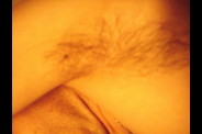 dessous de bras avant rasage