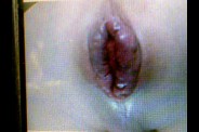 2010-03-05-35724