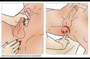 stimulation prostate etape 2