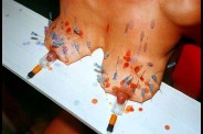 Aiguilles dans les seins (50)