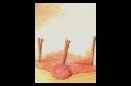 Aiguilles dans les seins2 (123)
