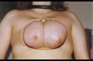 Travail des seins5 (213)