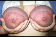 Travail des seins5 (296)