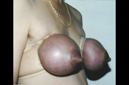 Travail des seins5 (379)
