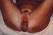 Travail des seins6 (153)