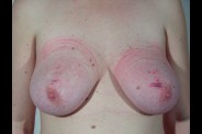 Travail des seins7 (57)