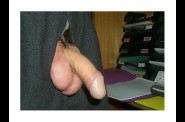slip4