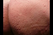 P1210458