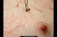 Aiguilles dans les seins1 (167)