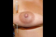 Aiguilles dans les seins1 (3)