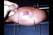 Aiguilles dans les seins1 (33)