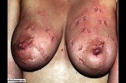Aiguilles dans les seins1 (59)