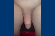 gros-plan-bite00043.jpg