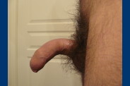 P1010707