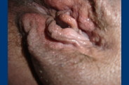 Bibiche