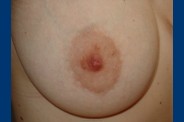 0377 022