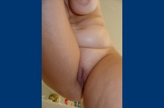 0377 077