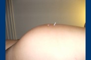 1 (2)