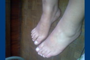 Pieds-03