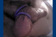 cockring 0274