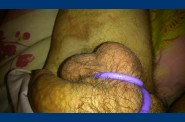 cockring 0276