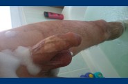 epilation (10)