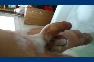 epilation (7)